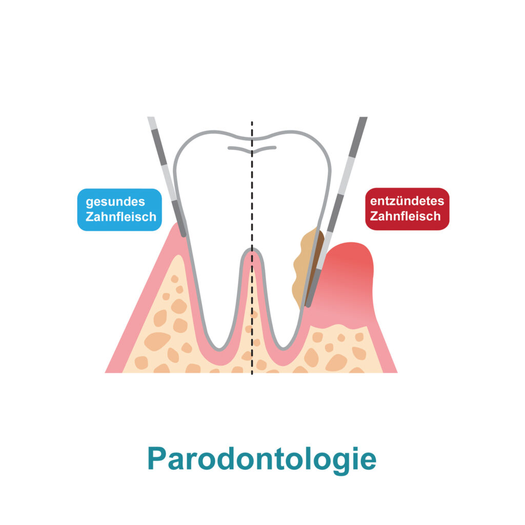Paradontologie in der Zahnarztpraxis Kräling